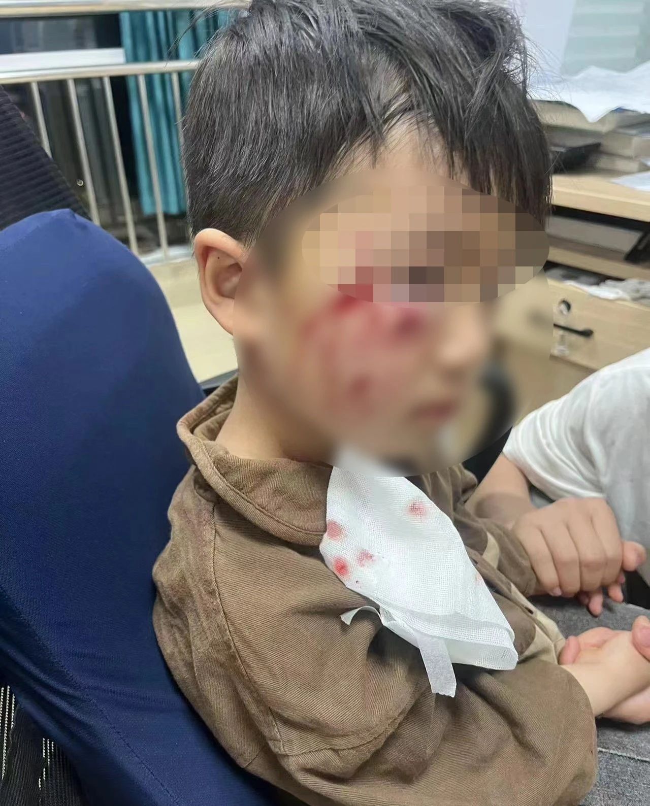 痛心！被咬傷18天后，3歲男童離世，母親發(fā)聲→